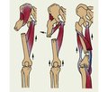 Variants to optimize medical and social adaptation  of gerontological patients with proximal femoral fractures