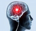 Терапевтический потенциал и перспективы применения препарата Ницериум (ницерголин) при хронических нарушениях мозгового кровообращения (научный обзор)