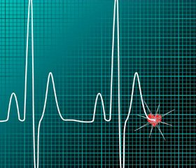 Диабетическая кардиальная автономная нейропатия: каковы перспективы в лечении?