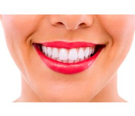 Виниры на зубы: ответы на часто задаваемые вопросы