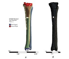 Biomechanical analysis of reliability of fragments fixation during the osteosynthesis of the proximal tibial fractures with LCP-plate and the intramedulary locking nail