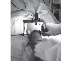 Substantiation of the method for determining the clinical and radiographic parameters of the hip joint in patients with cerebral palsy