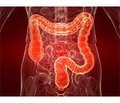 Extraintestinal manifestations as the clinical masks of inflammatory bowel diseases