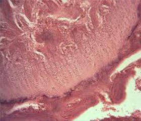 Зміни фагоцитарної ланки імунітету В щурів, що зазнали дозованої опікової травми та подальшого впливу поляризованого світла