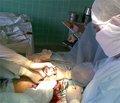Тактика в хірургічному лікуванні переломів проксимального метаепіфіза великогомілкової кістки